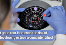 Research Reveals Genetic Link to Most Common Pediatric Bone Cancer