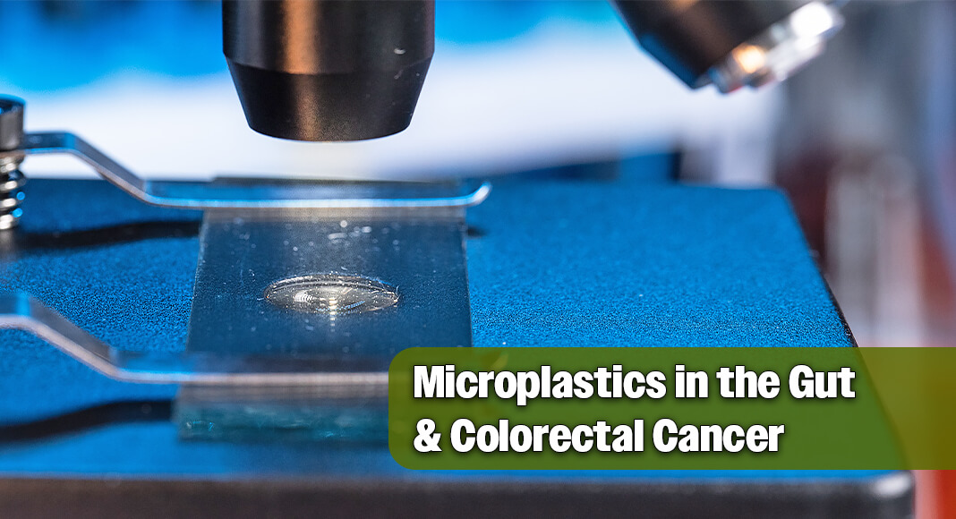 Microplastics are common and consist of tiny pieces of plastic that are 5 millimeters (mm) or less. Recent study results, which have not been published in a peer-reviewed journal yet, show that how microplastics may impact bacteria in the human gut. Image for illustration purposes