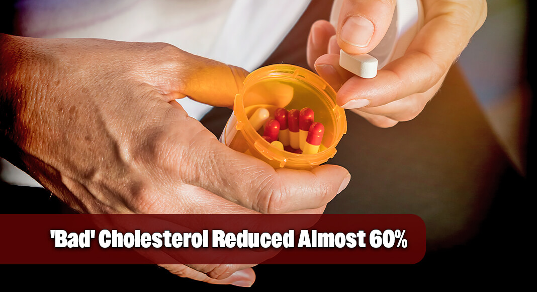 The study recruited people with heterozygous familial hypercholesterolemia, a genetic condition that causes the individual to have high levels of LDL, or “bad” cholesterol. Image for illustration purposes