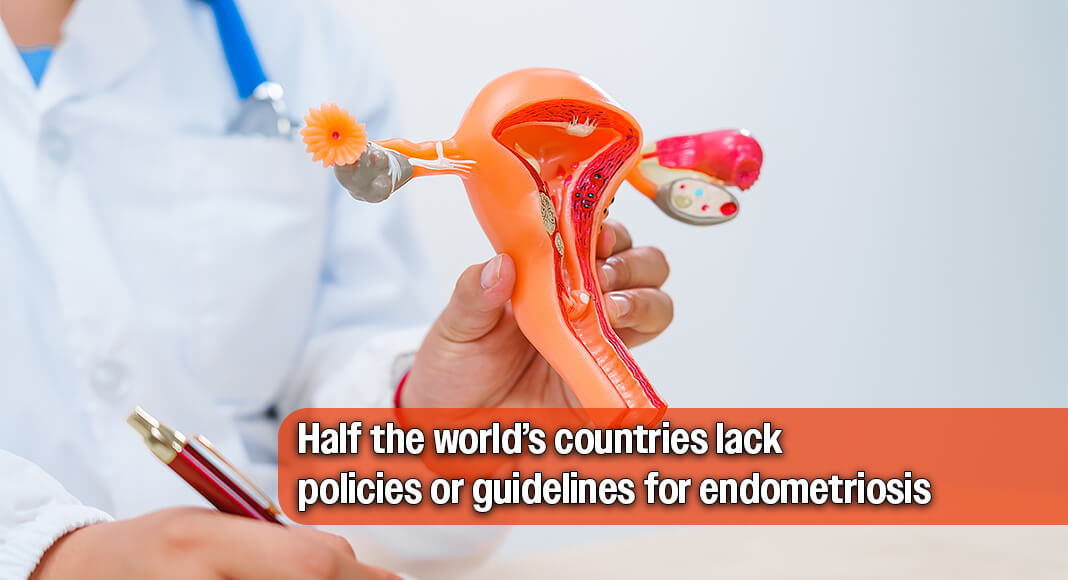 Endometriosis is estimated to affect one in 10 reproductive-aged women worldwide – but research reveals stark global inequities in how the chronic condition is recognized, treated and prioritized in national health systems. Image for illustration purposes