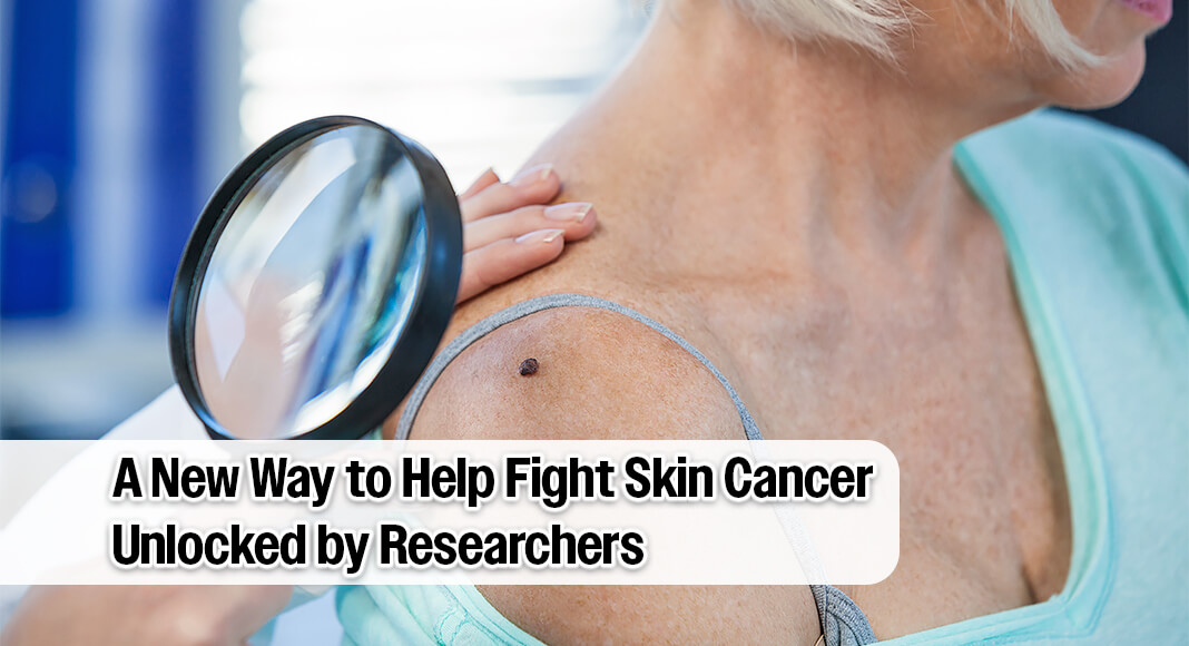 Researchers at the UNC School of Medicine and UNC Lineberger Comprehensive Cancer Center have identified a potential solution. In a new study published in the Journal of Clinical Investigation, researchers have found that by inhibiting a problematic protein, the immune system can better fight off melanoma, decreasing tumor growth and bolstering the body’s immune cells. Image for illustration purposes