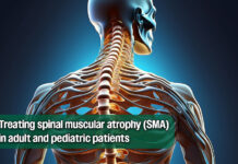 FDA Approves Gene Therapy for Treatment of Spinal Muscular Atrophy