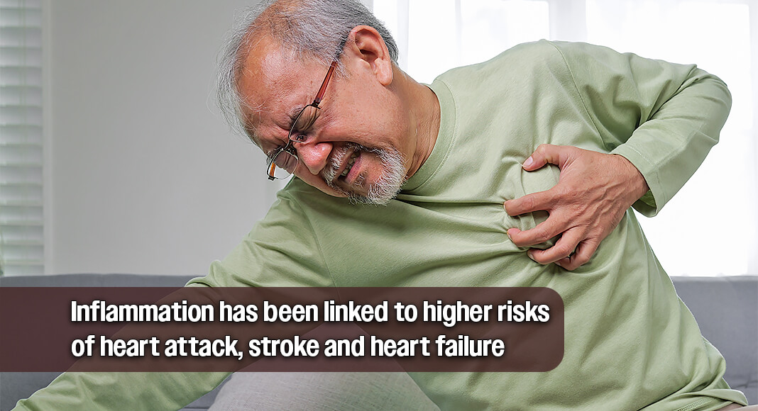 Inflammation has been linked to higher risks of heart attack, stroke and heart failure. The connections are drawing increased attention from researchers, who are still unraveling the details. But you don’t have to be an expert to know simple ways to protect yourself. Image for illustration purposes