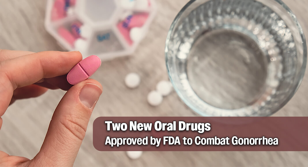 The FDA approved Nuzolvence (zoliflodacin) granules that dissolve in water. This medicine can treat uncomplicated urogenital gonorrhea in adults and children 12 years and older who weigh at least 77 pounds. The FDA also approved Blujepa (gepotidacin) oral tablets for the same condition in patients 12 years and older who weigh at least 99 pounds. This medicine is for patients who have few or no other treatment choices because of limited clinical safety data. Blujepa was first approved in March 2025 to treat urinary tract infections. Image for illustration purposes