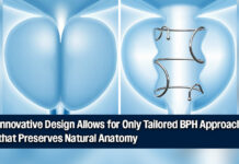 FDA Approves Zenflow Spring® System for BPH Treatment