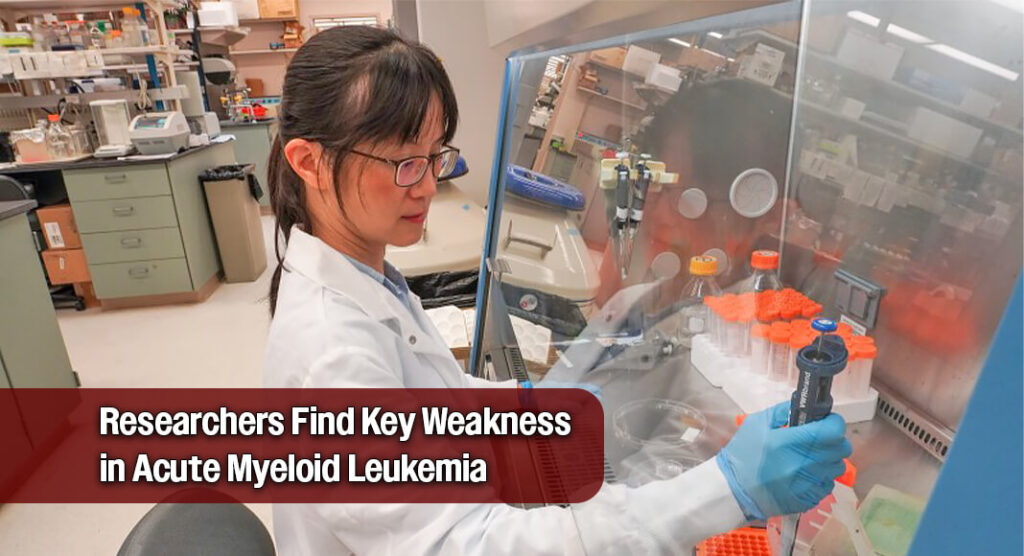 Scientists Identify a Treatable Vulnerability in Aggressive Blood Cancer