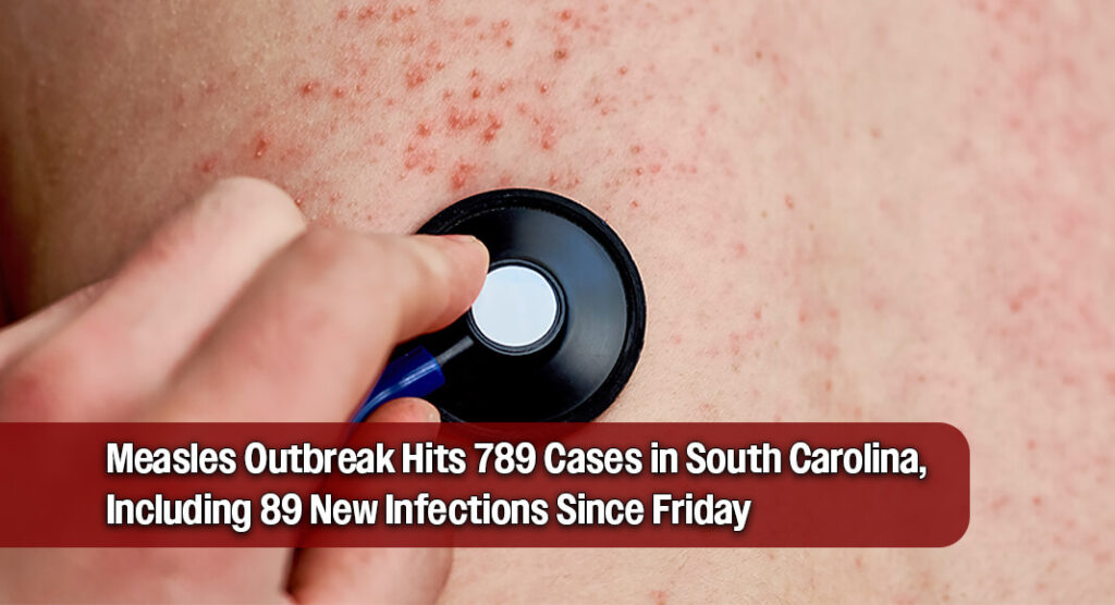 Measles Cases in South Carolina Surpass West Texas Outbreak as Numbers Climb Rapidly