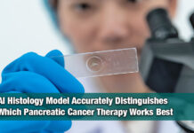 Cedars‑Sinai Develops AI Platform to Guide Pancreatic Cancer Treatment Choices