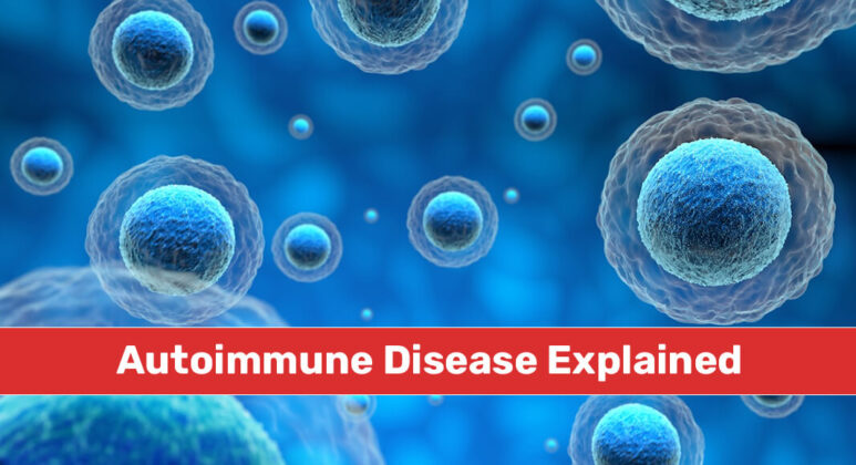 Autoimmune Disease Explained - Mega Doctor News