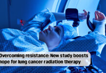 Study Reveals Mechanism to Overcome Lung Cancer Resistance to Radiation Therapy