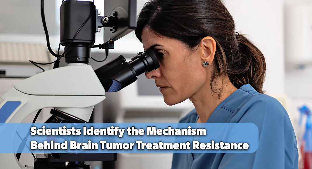 For patients diagnosed with IDH-mutant glioma, an incurable brain tumor that often affects adults in their 30s and 40s, treatment typically works at first. However, the cancer almost always returns, and when it does, it frequently stops responding to treatment. Image for illustration purposes