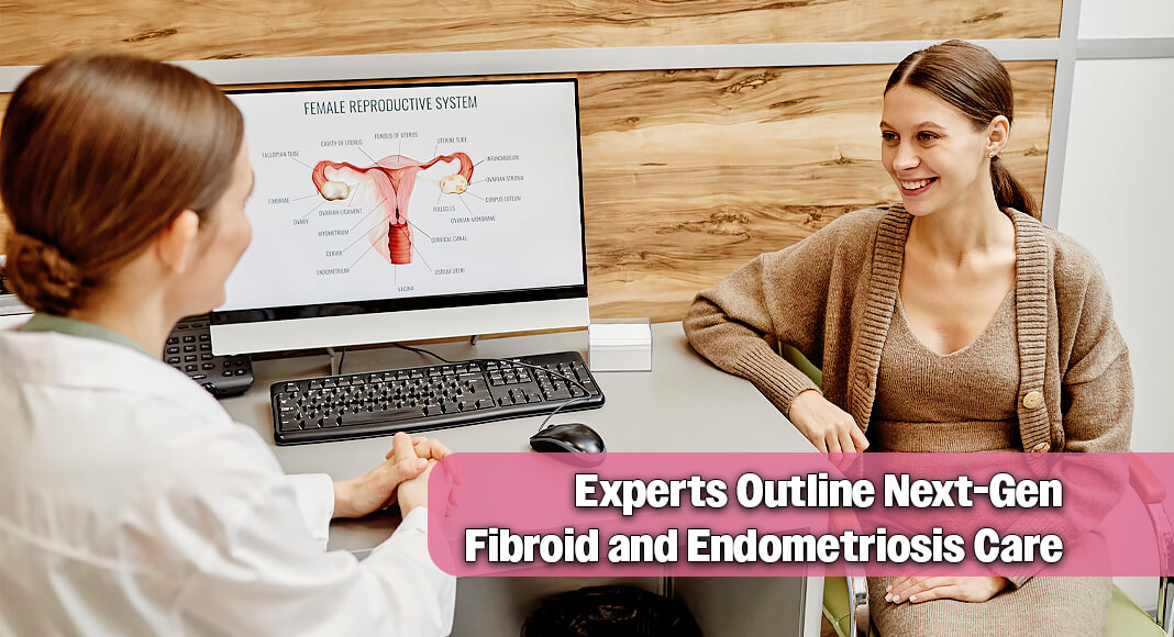 Endometriosis and uterine fibroids are two of the most common gynecological conditions. While they have important differences, they also have things in common. Both can lead to serious complications, affect fertility and have symptoms related to the menstrual cycle. Image for illustration purposes