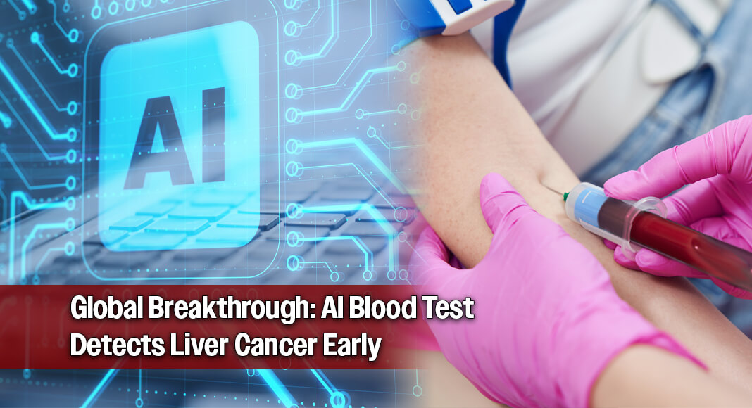 Researchers at the Johns Hopkins Kimmel Cancer Center validated an artificial intelligence (AI)-powered blood test that accurately detected liver cancer in people from two geographically and biologically distinct populations and also uncovered the underlying biological signals that make the test effective. Image for illustration purposes