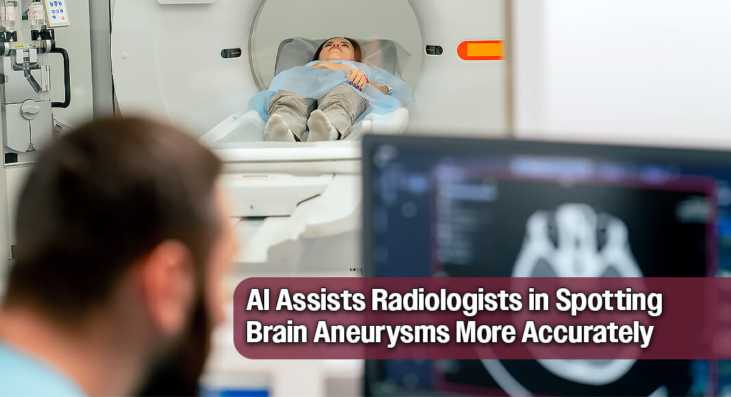 A new study suggests AI-assisted CT scans could help radiologists detect 39% more brain aneurysm cases. Image for illustration purposes