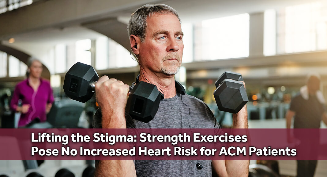 People living with arrhythmogenic cardiomyopathy (ACM), a heritable heart condition that can significantly increase risks for sudden cardiac death, are advised to avoid high-intensity aerobic exercise. However, questions remain about whether higher-intensity strength training, which affects the heart differently from endurance exercise, could be less risky. Image for illustration purposes