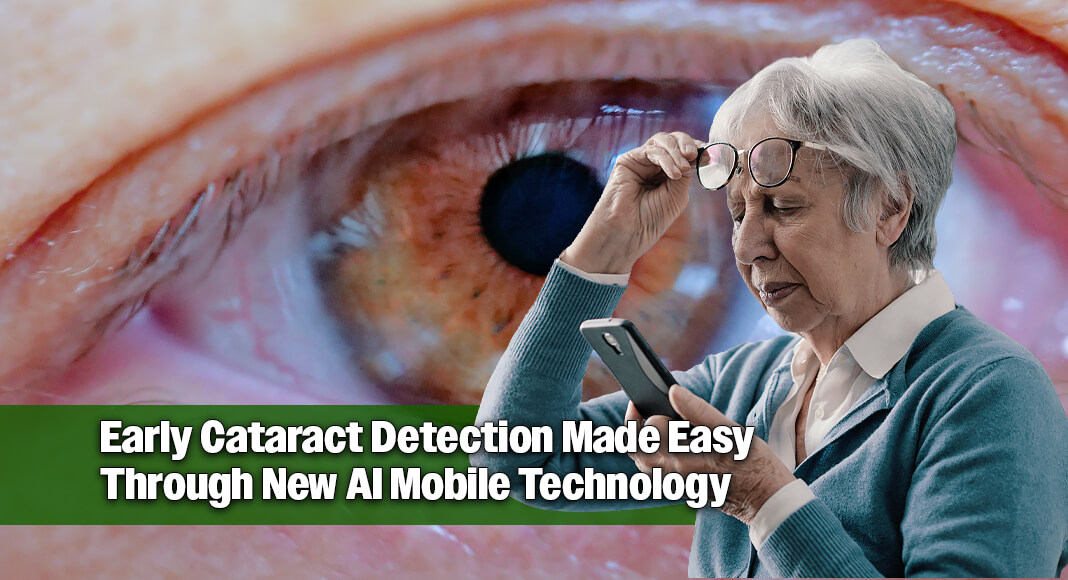 The team, which began building the tool in 2024, trained it on 12,439 eye images graded by specialists. The researchers then tested it on 4,000 hospital patients, checking its calls against ophthalmologists’ diagnoses. Image for illustration purposes