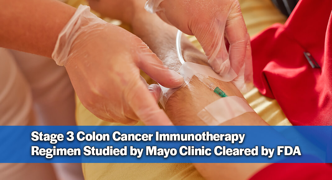 The Food and Drug Administration (FDA) has approved the immunotherapy drug atezolizumab in combination with chemotherapy for some patients with stage 3 colon cancer following surgery. The treatment is for patients whose tumors have deficient DNA mismatch repair, or dMMR. Image for illustration purposes