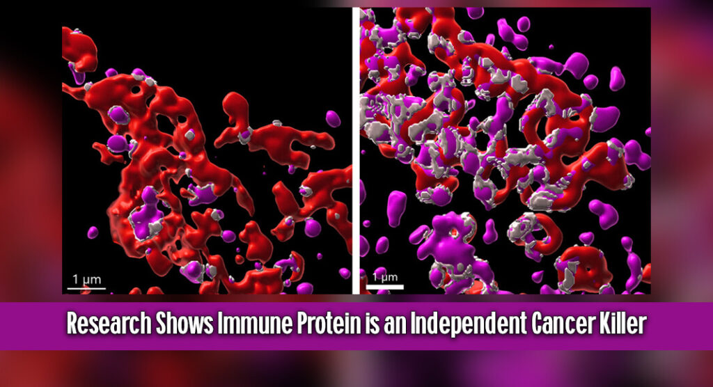 Perforin increases endosomal-mitochondrial contact sites in tumor cells. Left is without perforin; right is with perforin. Photo credit: University of Michigan Rogel Cancer Center via Newswise