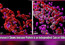 New Study Reveals Immune Protein Fights Cancer Alone